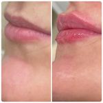 مرکز لیزر کلینیک زیبایی ماساژ گلاریس