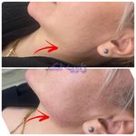 مرکز لیزر کلینیک زیبایی ماساژ گلاریس