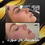 مرکز لیزر کلینیک زیبایی ماساژ گلاریس