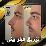 مرکز لیزر کلینیک زیبایی ماساژ گلاریس