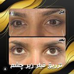 مرکز لیزر کلینیک زیبایی ماساژ گلاریس