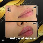 مرکز لیزر کلینیک زیبایی ماساژ گلاریس