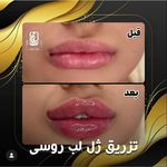 مرکز لیزر کلینیک زیبایی ماساژ گلاریس