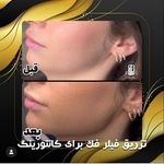 مرکز لیزر کلینیک زیبایی ماساژ گلاریس