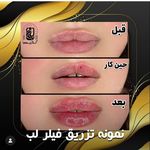 مرکز لیزر کلینیک زیبایی ماساژ گلاریس