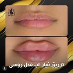 مرکز لیزر کلینیک زیبایی ماساژ گلاریس