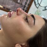 مرکز لیزر کلینیک زیبایی ماساژ گلاریس