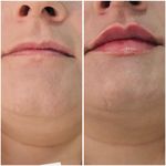 مرکز لیزر کلینیک زیبایی ماساژ گلاریس