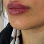 مرکز لیزر کلینیک زیبایی ماساژ گلاریس