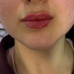 مرکز لیزر کلینیک زیبایی ماساژ گلاریس