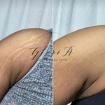 کلینیک زیبایی گلوریا