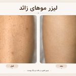 مرکز لیزر ،پوست و زیبایی کندی بیوتی