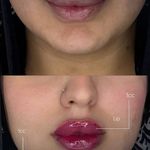 تزریقات زیبایی حدیث