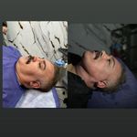 کلینیک جراحی سوپرکانتورینگ غبغب وی لاین