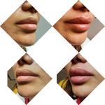 مرکز لیزر و کلینیک زیبایی دکتر خانجانی