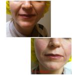 مرکز لیزر و کلینیک زیبایی دکتر خانجانی