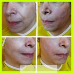 مرکز لیزر و کلینیک زیبایی دکتر خانجانی