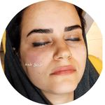 مرکز لیزر و کلینیک زیبایی دکتر خانجانی