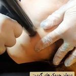 مرکز لیزر و کلینیک زیبایی دکتر خانجانی