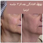 مرکز لیزر و کلینیک زیبایی دکتر خانجانی