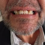 دندانسازی حسینی