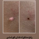 موسسه آموزش و درمان انواع ریزش مو ریشه