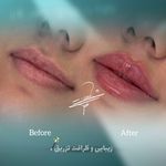 مطب پوست زيبايی ليزر دکتر شاه نعمت الهی