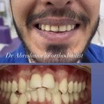 متخصص ارتودنسی دکتر ابریشم چی کرج