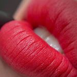 میکروبلیدینگ عسل علیزاده