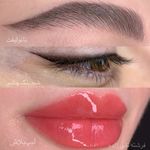 مرکز میکروبلیدینگ وفیبروز فرشته تقی زاده