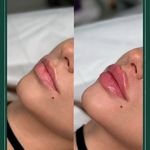 مرکز زیبایی مایلا