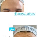 کلینیک تخصصی پوست و زیبایی ملینا