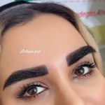 کاشت ابرو مریم شیرزادگان