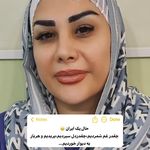 کاشت ابرو مریم شیرزادگان