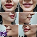 مطب پوست ،مو زیبایی دکتر فاطمه قره داغی