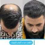 کلینیک زیبایی گلبان