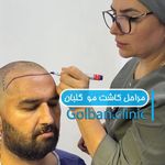 کلینیک زیبایی گلبان