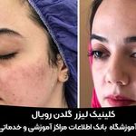 کلینیک زیبایی گلدن رویال مشهد