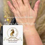 سالن پاکسازی پوست وفیشیال صورت زیبارو