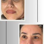 خدمات تخصصی فیشال و پاکسازی پوست صبا