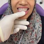 دندانسازی و لابراتوار محتشم