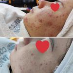 پاکسازی پوست وفیشال تخصصی فاطیما