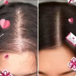 کلینیک لیزردکتر مریم سلیمانی باجک قم