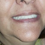 مطب ایمپلنت دکتر نیما شفیعی