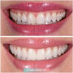 مركز دندانپزشکی دکترفرنوش عیوضی