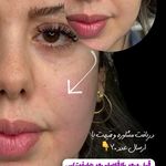 کلینیک زیبایی، لیزر و تخصصی زنان نفس