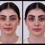 آموزش و خدمات تخصصی اکستنشن ولیفت زهرا