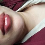 کلینیک پوست و لیزر ژینوس دکتر مقدم