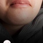 کلینیک پوست و لیزر ژینوس دکتر مقدم