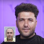 کلینیک پوست مو و زیبایی نوین ایرانا